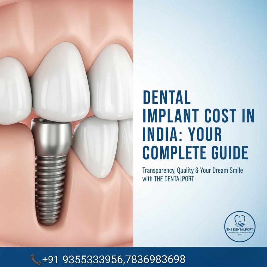 Dental Implant Cost in India 2025: Complete Guide & Price Breakdown (Noida)